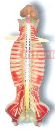 MAGNET-HANGING HUMAN SPINAL CORD MODEL IN SPINAL CANAL